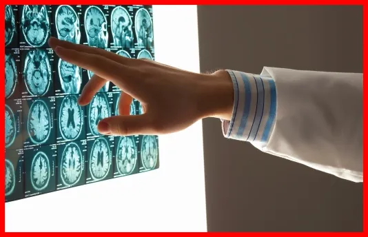 CT vs MRI 차이 결과