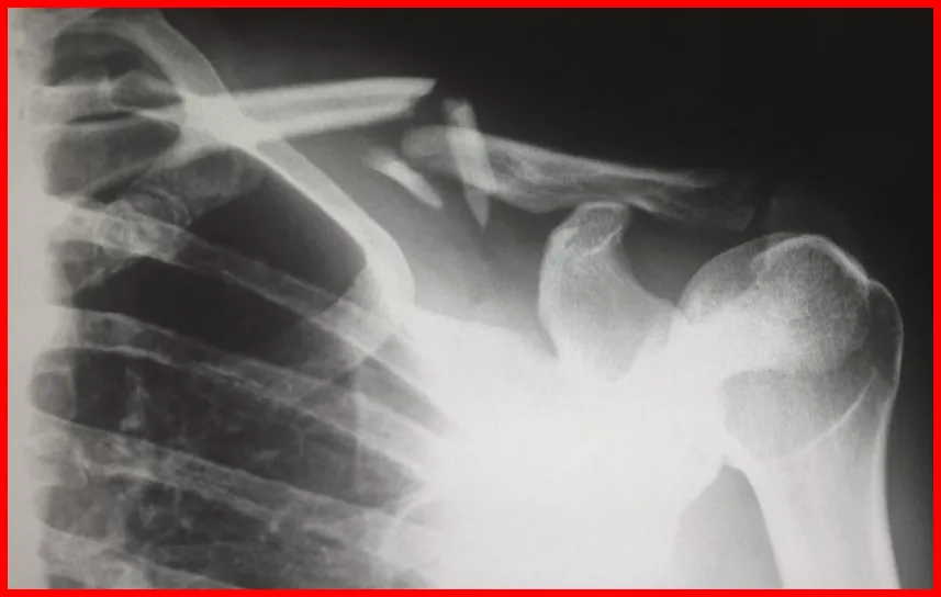 급여 비급여 차이2