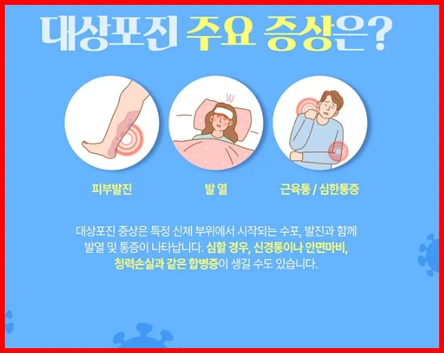 대상포진 주요 증상