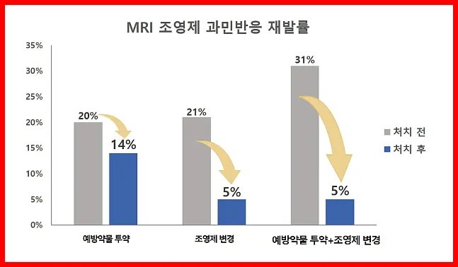 조영제 부작용1